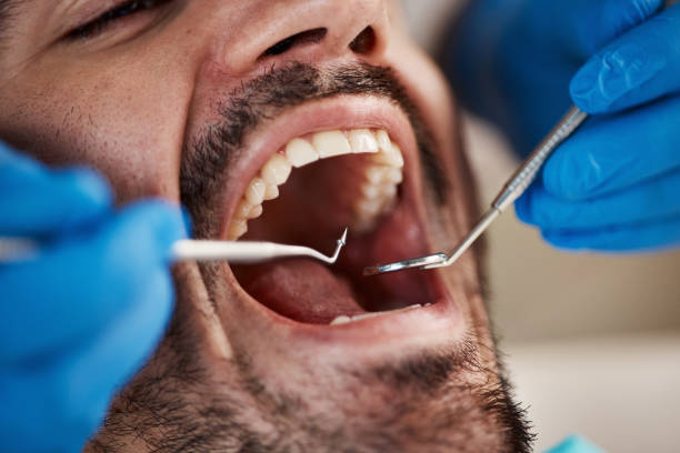 Tooth Infection Emergency Dentist in MD