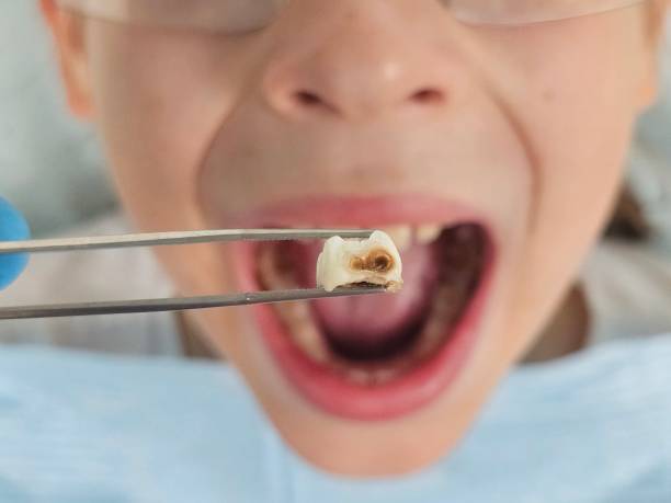 Best Broken Tooth Emergency  in Lanham, MD